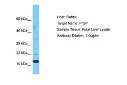 PIGP Rabbit anti-Human, Polyclonal, Novus Biologicals 0.1ml; Unconjugated:Antibodies,
